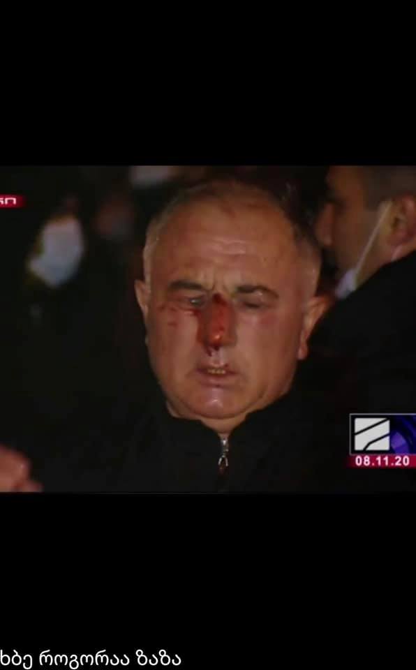 “ომის ვეტერანი დაასახიჩრეს ცესკოსთან – ექიმები იბრძვიან მისი თვალის გადასარჩენად”