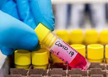 9 გარდაცვლილი და 1219 ინფიცირებული – კორონავირუსის დღევანდელი სტატისტიკა