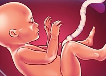 რევოლუციური ქირურგია ემბრიონებზე – 32 ბავშვი  პარალიზებას გადაურჩა