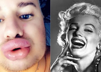 ბიჭმა ათასობით დოლარი დახარჯა, რათა მერლინს დამსგავსებოდა – როგორ გამოიყურებოდა იგი ოპერაციამდე? – (ფოტოები)