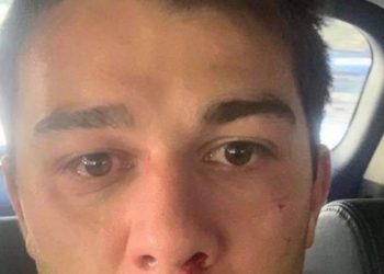 ,,აქ ჩანს რეალურად ვინ მიცავდა და ვინ მისწორდებოდა ფიზიკურად” – რა ფოტოს აქვეყნებს რატი წვერავა