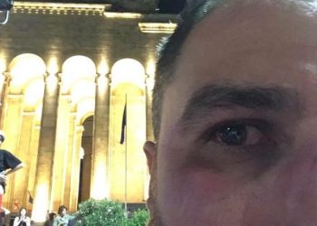 პარლამენტთან, აქციაზე პოეტი ირაკლი კაკაბაძე დაშავდა