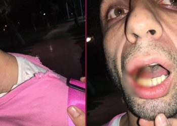 “ბო@ებო, პიტბულებივით ზრდით შვილებს…” – ახალგაზრდა, რომელიც მაისურის ფერის და თმის სიგრძის გამო სცემეს