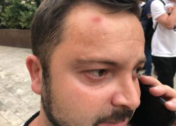 პარლამენტთან ოპერატორს დღესაც დაესხნენ თავს – დეტალები