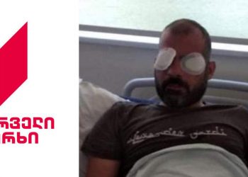 “ათობით ადამიანმა მცემა ჯოხებით, მერე თვალებში რაღაც შემასხეს” – პირველი არხის ოპერატორს თვალები დაუზიანეს