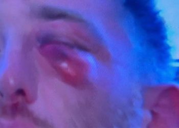 “რამდენიმე ათეული ადამიანი გამისწორდა” – “ფორმულას” გადამღებ ჯგუფს თავს დაესხნენ