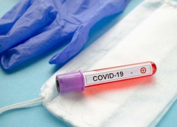 დღე-ღამეში 48 კოვიდინფიცირებული გარდაიცვალა – ბოლო 24 საათის სტატისტიკა