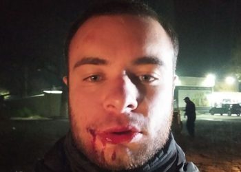 აქციიდან წასულ ახალგაზრდას თავს დაესხნენ