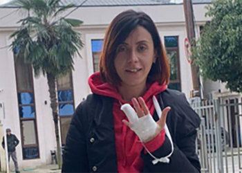 “ცხრა თითითაც ვიბრძოლებ” – ანი წითლიძე