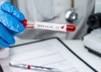 კოვიდინფიცირების ახალი შემთხვევებიდან 820 თბილისში, 375 იმერეთში, 128 კი ქვემო ქართლში გამოვლინდა