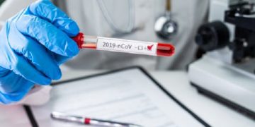 კოვიდინფიცირების ახალი შემთხვევებიდან 820 თბილისში, 375 იმერეთში, 128 კი ქვემო ქართლში გამოვლინდა