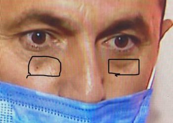 აი ეს სისხლნაჟღენთების მსგავსი რაღაცეები, მარტოობაში ხანგრძლივი და მტანჯველი ფიქრის კვალია? – ნიკა გვარამია ფოტოს აქვეყნებს