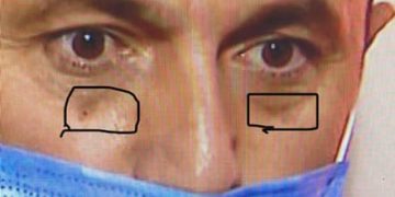 აი ეს სისხლნაჟღენთების მსგავსი რაღაცეები, მარტოობაში ხანგრძლივი და მტანჯველი ფიქრის კვალია? – ნიკა გვარამია ფოტოს აქვეყნებს