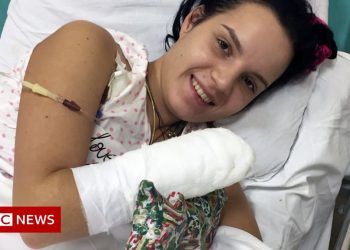 370 000 ევრო ნაჯახით მოჭრილი ხელის სანაცვლოდ – სასტიკი ოჯახური ძალადობა რუსეთში