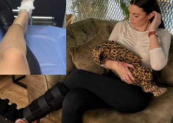 “ქუსლებიდან ჩამოდით” – ალექსანდრა პაიჭაძემ ფეხი მოიტეხა