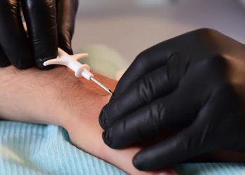 კანქვეშა ჩიპები საქართველოში მომავალი წლიდან შემოვა – დეტალები