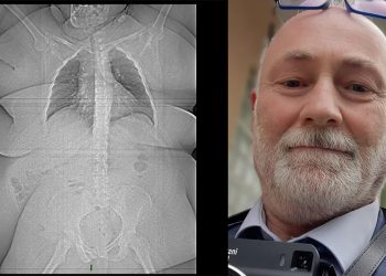 “მსუქანო, აიცერი! კოვიდი თუ დაგემართა, ჯობია იყო ასთმიანი, ვიდრე მსუქანი, უნდა გაგიმართლოს, რომ შეძლო იცოცხლო” – გიგა გელენიძე