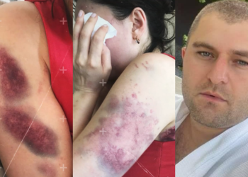 ხანჯლით მიყენებული ჭრილობები, გატეხილი თავი და სისხლჩაქცევები – მოსამართლემ ცოლზე ძალადობაში ბრალდებული გაათავისუფლა