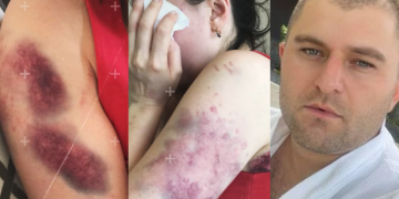 ხანჯლით მიყენებული ჭრილობები, გატეხილი თავი და სისხლჩაქცევები – მოსამართლემ ცოლზე ძალადობაში ბრალდებული გაათავისუფლა