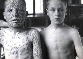 “მარცხნივ ხედავთ ადამიანს, რომელსაც „ცილა“ არ აქვს, მარჯვნივ კი „ცილიანი“, სახელმწიფოს მიერ „რაკამ დაყენებული“ ადამიანია” – ბექა მამუკაშვილი