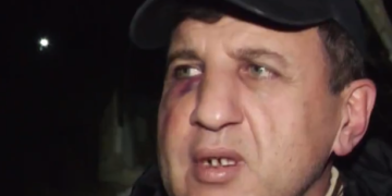 ეს იყო ღარიბაშვილის კლანის შეკვეთილი თავდასხმა ჩემი პოლიტიკური აქტივობის გამო – „გირჩი მეტი თავისუფლების“ წევრი