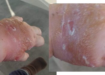 (ფოტოები) – რა შეემთხვა ბავშვს სამედიცინო ცენტრ “იავნანაში” და რას პასუხობს ექიმი მოქალაქეს?