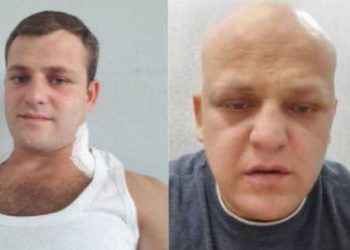 “გევედრებით, ყველამ გააზიარეთ, რომ ნახონ, რა დღეში ჩამაგდო მებრძოლი ადამიანი საქართველოს ჯანდაცვის ახალმა მინისტრმა!!!”-გიორგი ცეცხლაძე