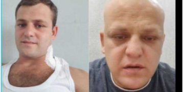 “გევედრებით, ყველამ გააზიარეთ, რომ ნახონ, რა დღეში ჩამაგდო მებრძოლი ადამიანი საქართველოს ჯანდაცვის ახალმა მინისტრმა!!!”-გიორგი ცეცხლაძე