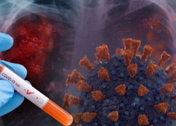 22 444 ახალი შემთხვევა და კიდევ 53 გარდაცვლილი – 10 თებერვლის კოვიდსტატისტიკა