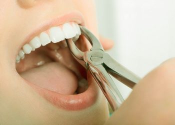 „ექვს კბილს თუ ამოიღებთ, მეშვიდე საჩუქრადო“ – „სტუდენტური შეღავათი“ სტომატოლოგიურ კლინიკაში