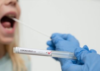 კორონავირუსზე PCR ტესტირება აღარ დაფინანსდება