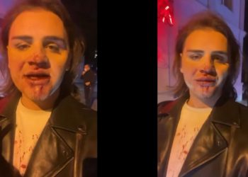 დიზაინერი, გიორგი მასხულია სცემეს – ,,გთხოვთ, ხალხო, დამიდექით გვერდით!“