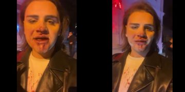 დიზაინერი, გიორგი მასხულია სცემეს – ,,გთხოვთ, ხალხო, დამიდექით გვერდით!“