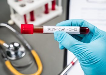 საქართველოში კორონავირუსის 3 115 ახალი შემთხვევა გამოვლინდა, გარდაიცვალა 43 პაციენტი