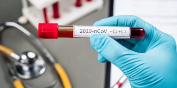 საქართველოში კორონავირუსის 3 115 ახალი შემთხვევა გამოვლინდა, გარდაიცვალა 43 პაციენტი