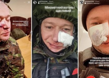 რუსმა ოკუპანტებმა ცნობილი უკრაინელი მომღერალი დაჭრეს