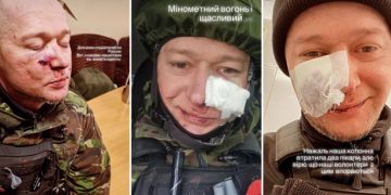 რუსმა ოკუპანტებმა ცნობილი უკრაინელი მომღერალი დაჭრეს