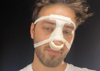 “ეს „ჭინჭი დამრტყმელები“ ნაკლებად მადარდებს, უნდა დაისაჯონ ო რ გ ა ნ ი ზ ა ტ ო რ ე ბ ი” – თორნიკე მანდარია !