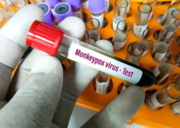 ნიუ-იორკში „მაიმუნის ყვავილის“ გამო საგანგებო მდგომარეობა გამოცხადდა