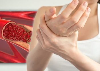 COVID-19-ის შემთხვევაში თრომბთან დაკავშირებული პრობლემები, რა არის თრომბოემბოლია?