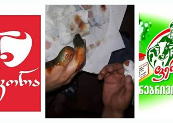 (+18) „მახსოვს, როგორ ასხამდა სისხლი ჩემი ორივე ხელიდან…“ – შემზარავი ფაქტი კომპანიაში, სადაც „ნიკორა“ პროდუქციას აწარმოებს