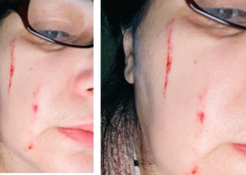 “ნუ გაწირავთ ადამიანებს, ნუ აიძულებთ იყვირონ – მიხედეთ” – იარაჯული