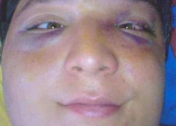 “მესმოდა როგორ გეგმავდნენ ჩემს მოკვლას, ან წამალი გავუკეთოთ ან ჩამოვკიდოთო” – გიორგი გაბედავა