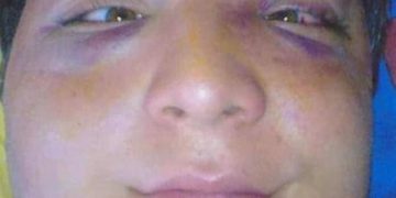 “მესმოდა როგორ გეგმავდნენ ჩემს მოკვლას, ან წამალი გავუკეთოთ ან ჩამოვკიდოთო” – გიორგი გაბედავა