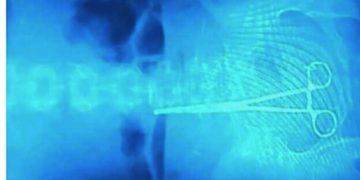 “ოპერაციისას მაკრატელი მუცელში დარჩათ – 3 თვე ტკივილები აწუხებდა” – მედია