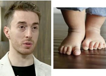 “ჯობს, ბავშვს არ ეცვას ფეხსაცმელი, როცა ფეხსაცმელი აცვია 6 ათასი რეცეპტორი იძინებს” – ღოღობერიძე