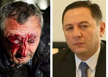 “ზუსტად ვერ გეტყვით, სად დაკარგა თვალი” – შსს ახალ დაკავებებს აანონსებს