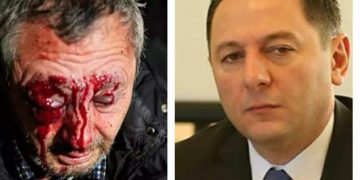 “ზუსტად ვერ გეტყვით, სად დაკარგა თვალი” – შსს ახალ დაკავებებს აანონსებს 