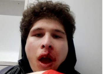 “რუსეთუმეებო მოგიტ@@ნთ პუტინი!” – დავით ხუფენია