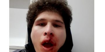 “რუსეთუმეებო მოგიტ@@ნთ პუტინი!” – დავით ხუფენია